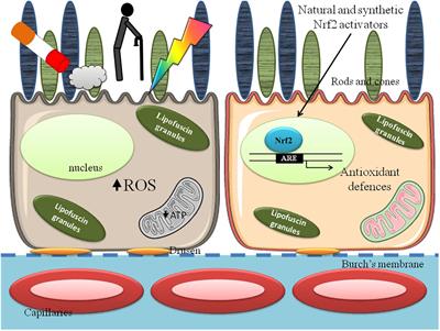 Oxidative Stress in Age-Related Macular Degeneration: Nrf2 as Therapeutic Target